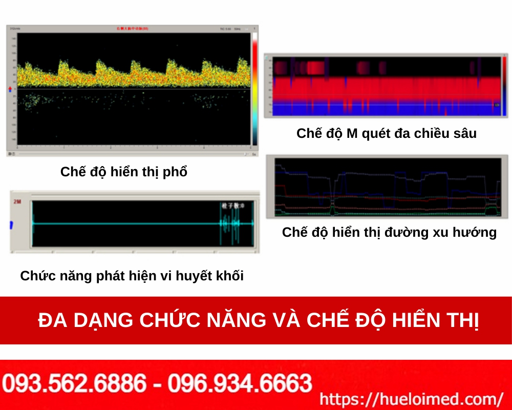 Máy phân tích lưu lượng máu Doppler xuyên sọ KJ-2V4M