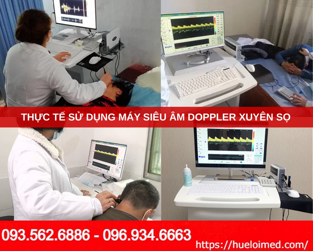 Máy phân tích lưu lượng máu Doppler xuyên sọ KJ-2V4M
