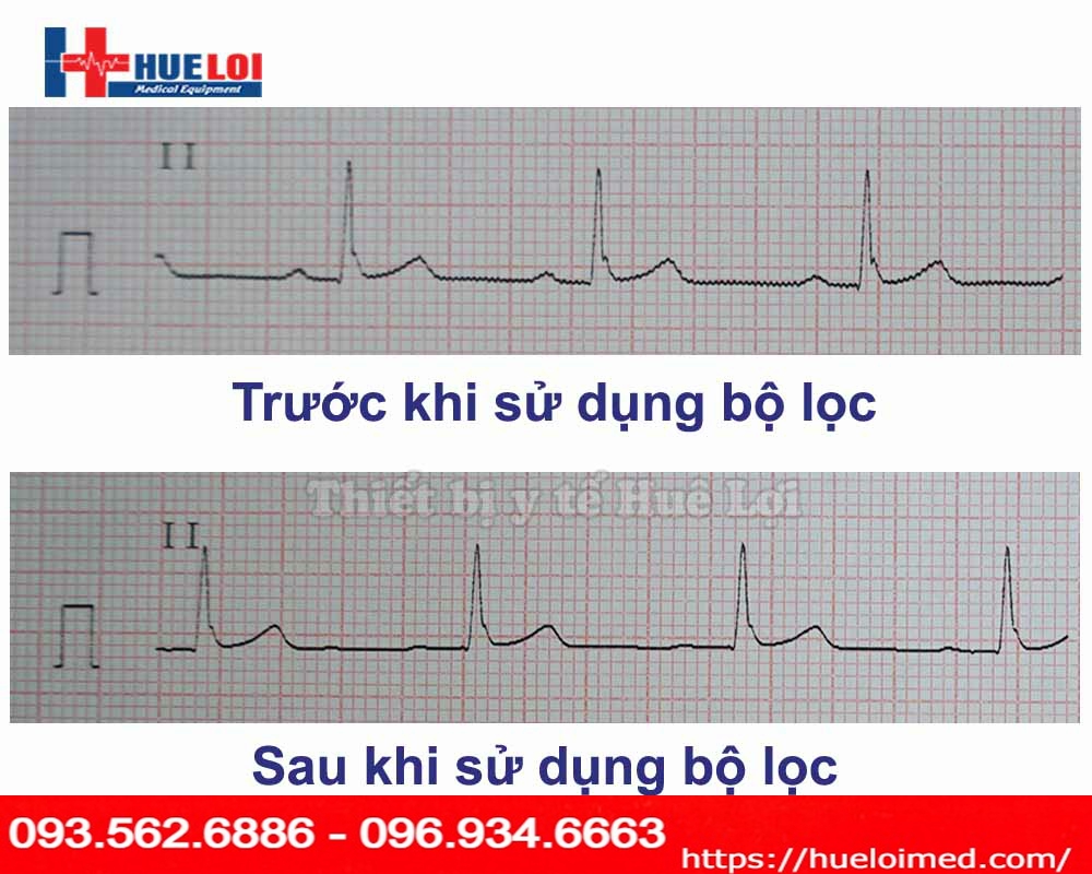 Máy điện tim 6 kênh Contec-600G