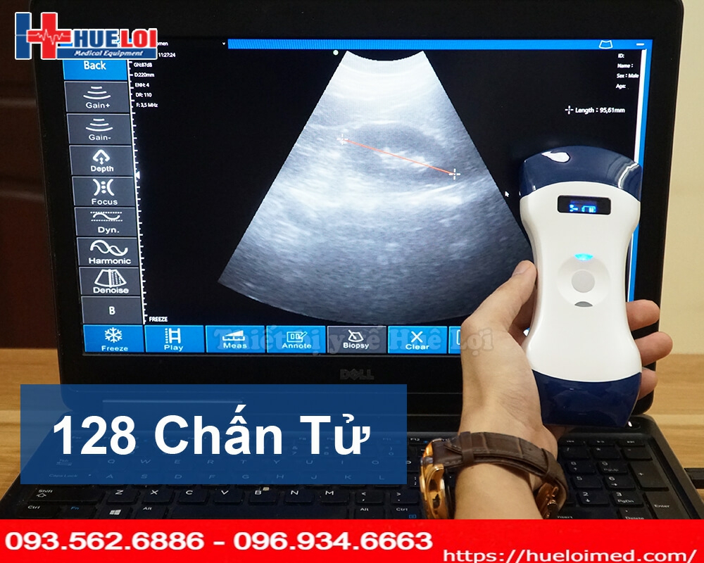 siêu âm cầm tay kết nối với máy tính