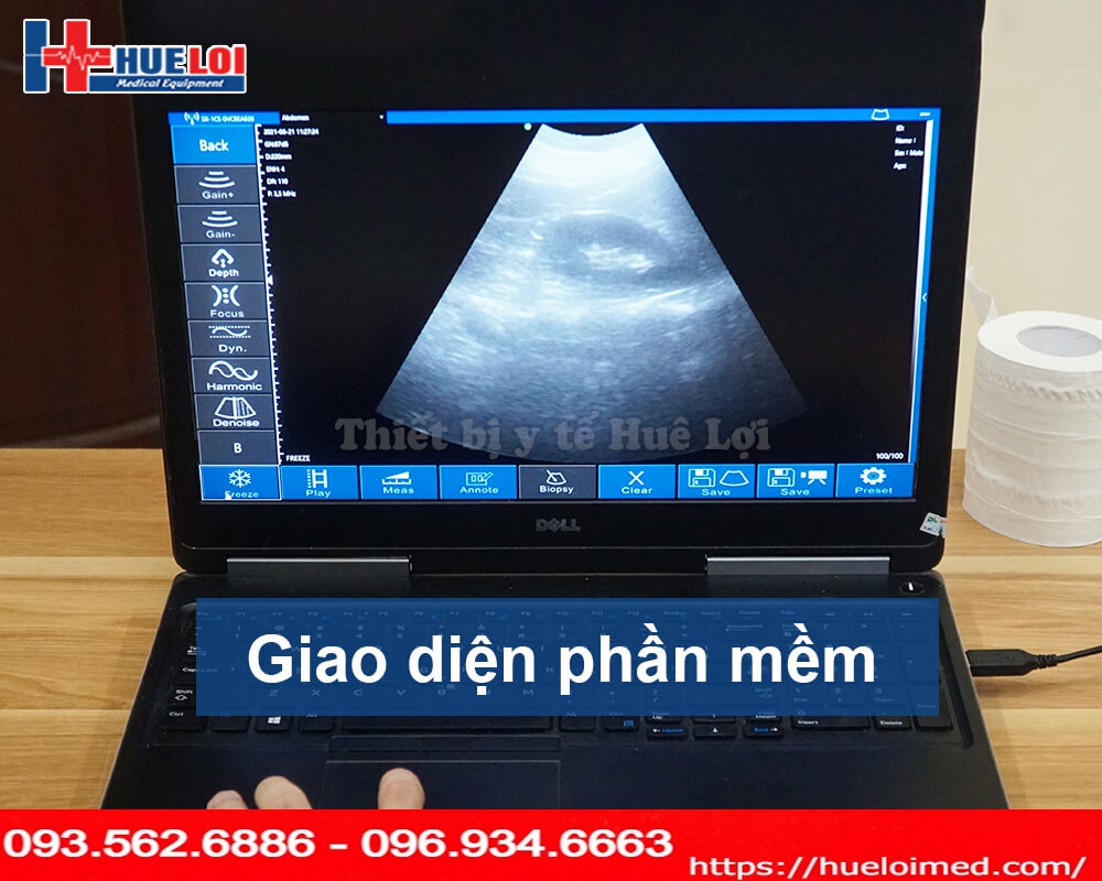 giao diện phần mềm máy siêu âm không dây