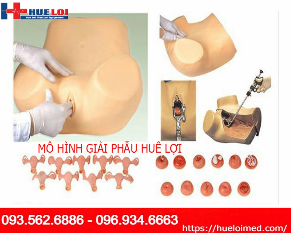 Mô Hình Khám Chẩn Đoán Các Bệnh Lý Phụ Khoa