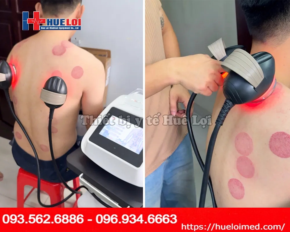 Máy điện sinh học thế hệ mới nhất