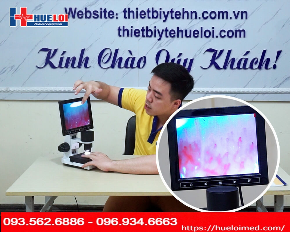 Kính Hiển Vi Soi Mạch Máu