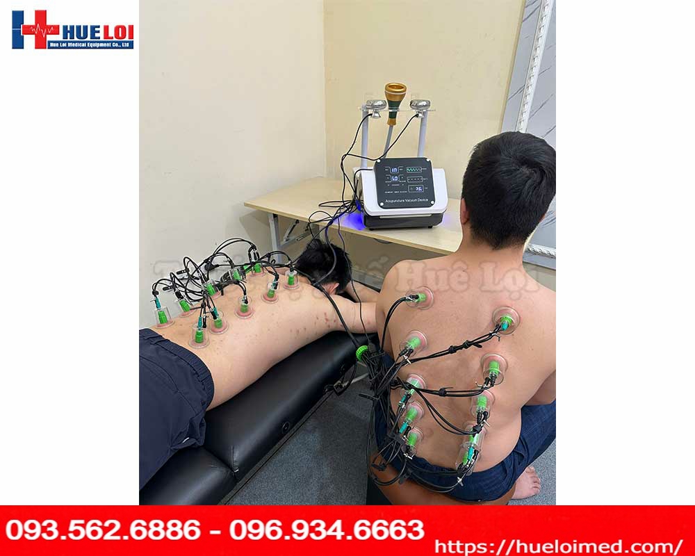 Máy điện châm không kim kết hợp điện xung