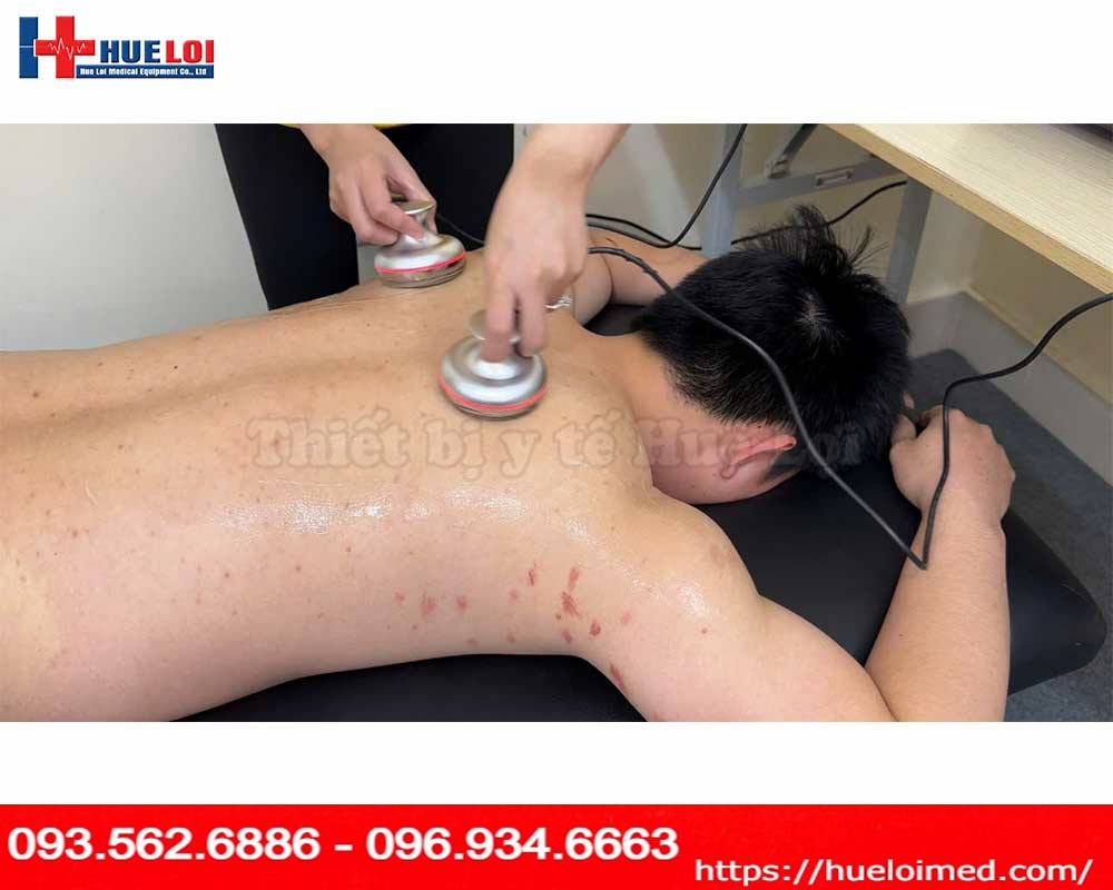 Máy điện châm không kim kết hợp điện xung