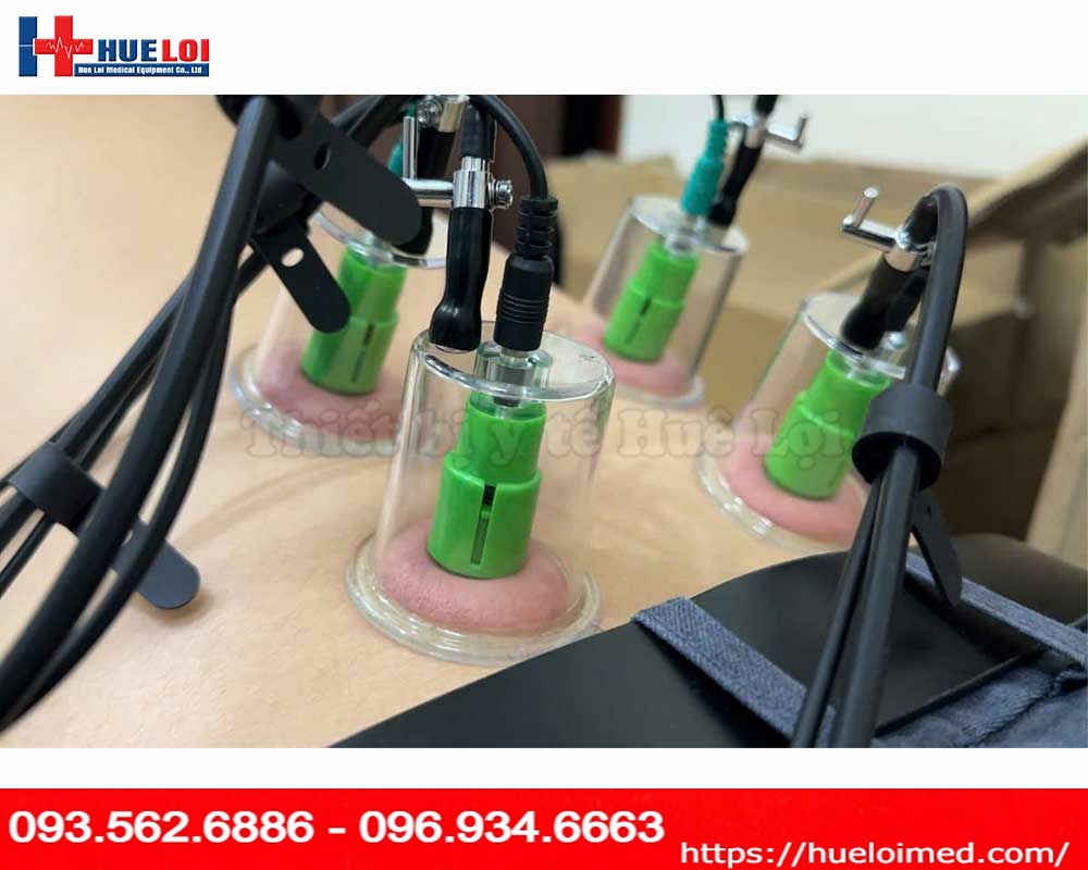 Máy điện châm không kim kết hợp điện xung