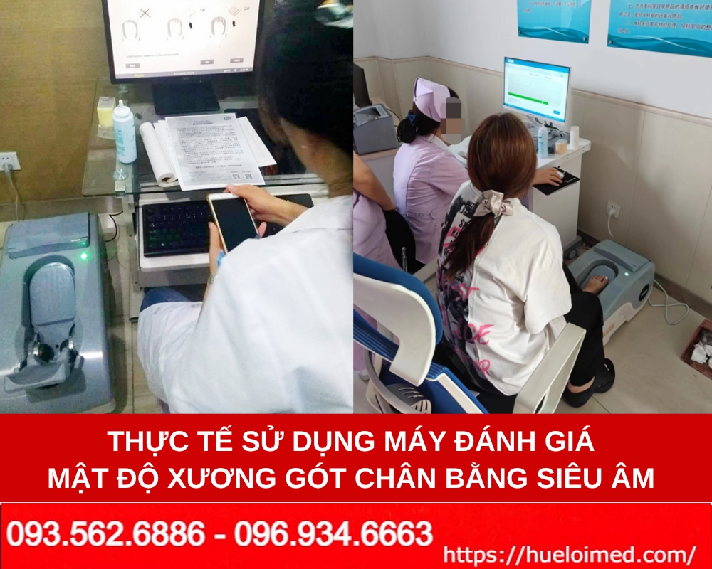 thiết bị đánh giá loãng xương gót chân bằng sóng siêu âm OSTEOKJ3000