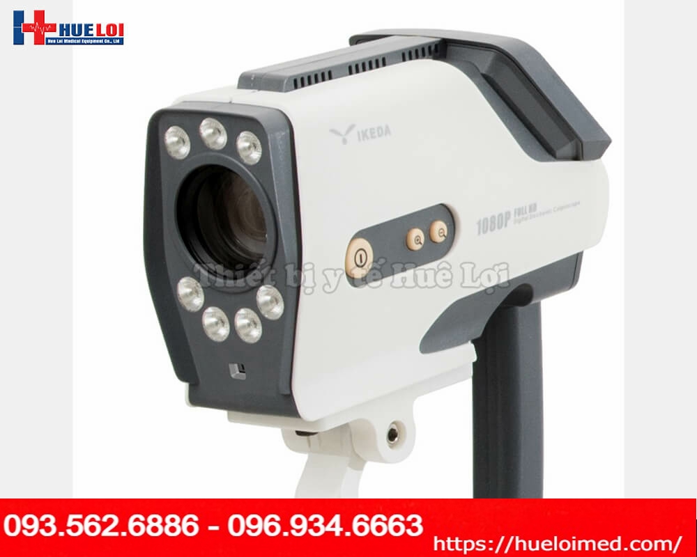 MÁY SOI CỔ TỬ CUNG YIKEDA FULL HD 3003