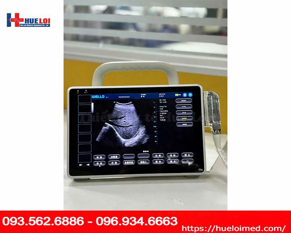 máy siêu âm xách tay cảm ứng Well.D model P10