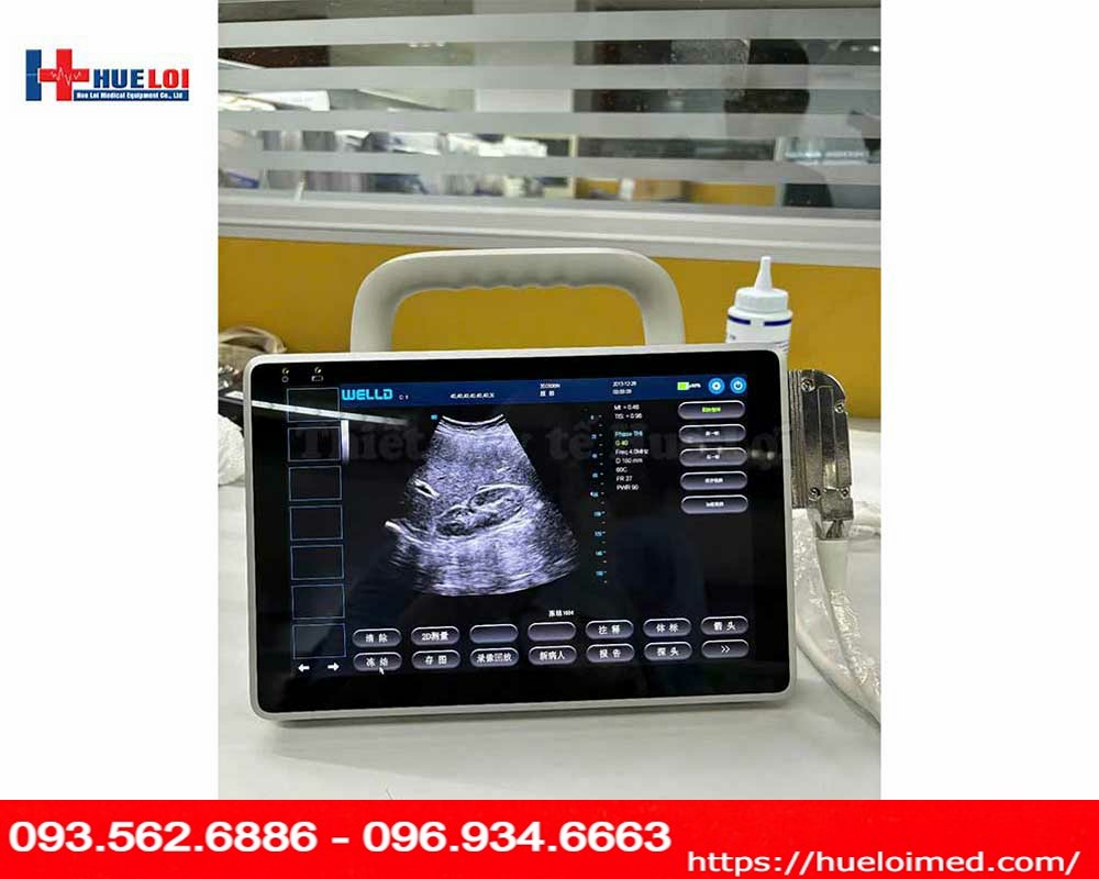 máy siêu âm xách tay cảm ứng Well.D model P10