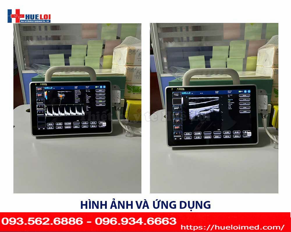 máy siêu âm xách tay cảm ứng Well.D model P10