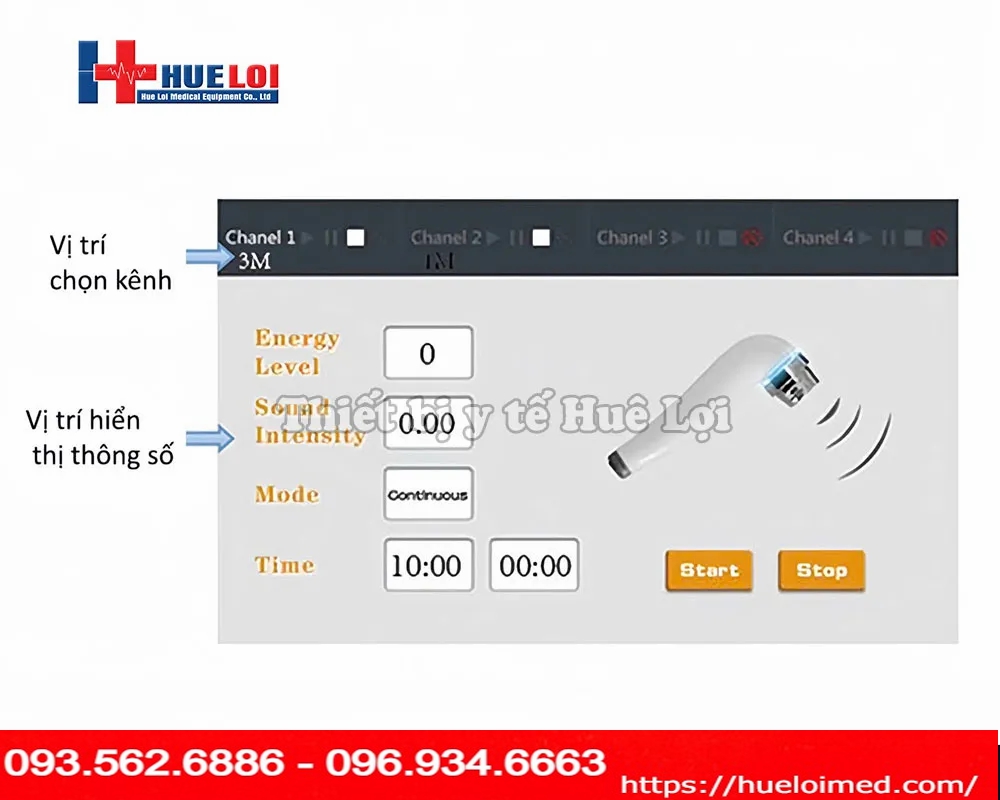 Siêu âm trị liệu đa tần giá rẻ