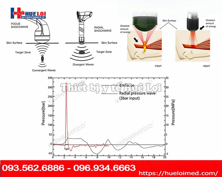 máy xung kích trị liệu EMFOCUS